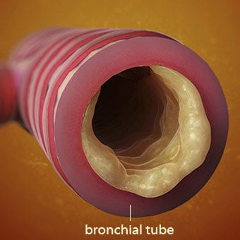 Phlegm and mucus can both be caused by seasonal allergies or respiratory infections.