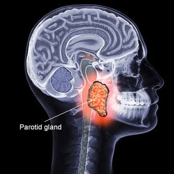 The illustration shows where the parotid gland is located.