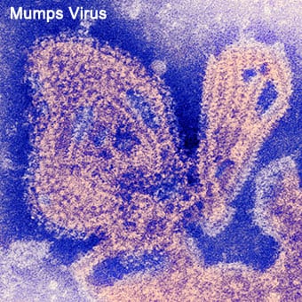 Negative stained transmission electron micrograph (TEM) depicts the ultrastructural features displayed by the mumps virus.