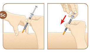 Use an alcohol wipe Â to clean the injection Â site - Illustration
