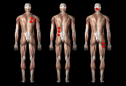 New bouts usually show up on different parts of your body.