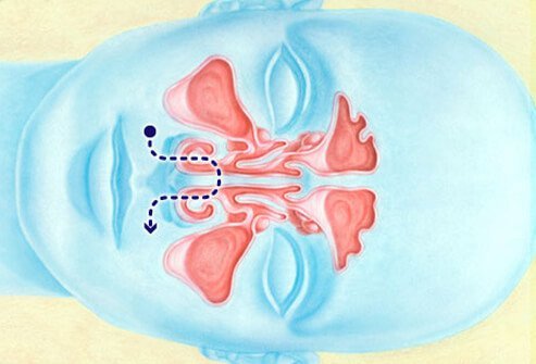 Illustration of the body's nasal irrigation.