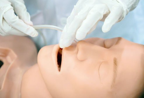 Nasogastric intubation, or inserting a tube through the nose and into the stomach, may be done to place a feeding tube or for diagnostic purposes (esophagoscopy or upper endoscopy).