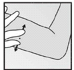 Stretch the skin around the insertion site -  Illustration