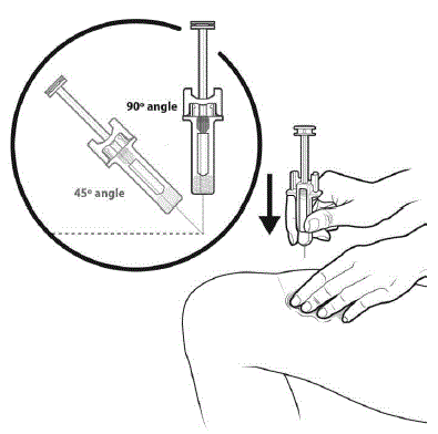 Insert the needle at a 45 to 90 degree angle into the skinl - Illustration