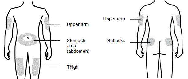 Select and Prepare the Injection Site - Illustration