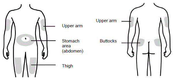 Choose the injection site - Illustration