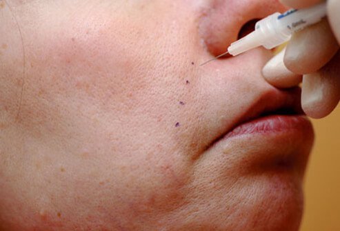 Cosmetic fillers add substance to skin in order to lift up areas that are sinking.