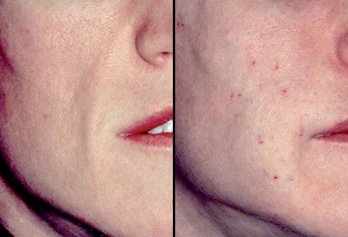 The anatomy of the aging face is now better understood than in the past.