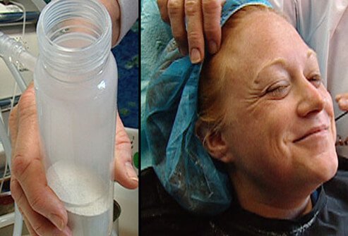 A woman after a microdermabrasion treatment.