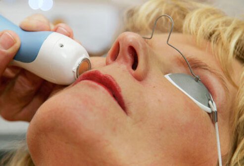 Radio waves can improve the appearance of sun-damaged skin.