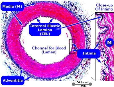 Picture of Normal Coronary Artery