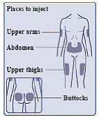Keep the needle in your skin after the dose
counter has returned to “0” and slowly count to 6 - Illustration