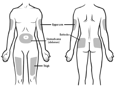 Prepare and clean the injection site(s) - Illustration