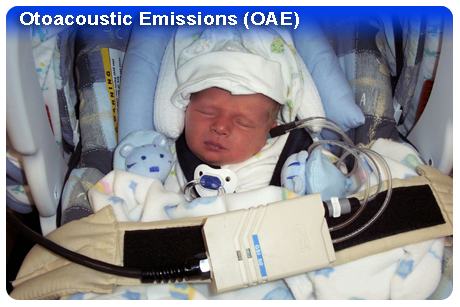 Otoacoustic Emissions (OAE) Photo - Hearing Loss in Children