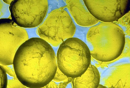 Omega-3s can lower your triglycerides, a blood fat that's linked to heart disease.