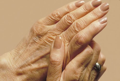Studies suggest omega-3s can improve joint symptoms such as pain and stiffness from rheumatoid arthritis.