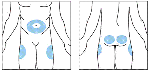 Injection site - Illustration