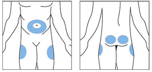 Selecting the injection site - Illustration