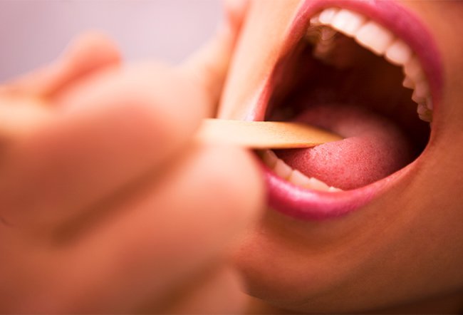what are 5 oral health diseases