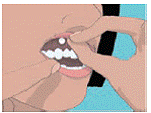 Applying the ORAVIG tablet - Illustration