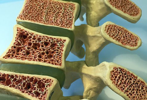 Osteoclasts travel over the surface of the bone matrix and secrete acids and enzymes to disintegrate it, forming a little bit on the surface of the bone. 