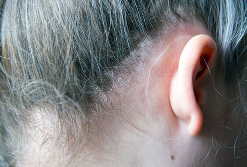 Otoplasty is a cosmetic surgical procedure to reduce the prominence and shape of unusually large or protruding ears.