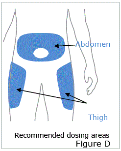 OTREXUP PFS should be injected into the stomach (abdomen) or thigh - Illustration
