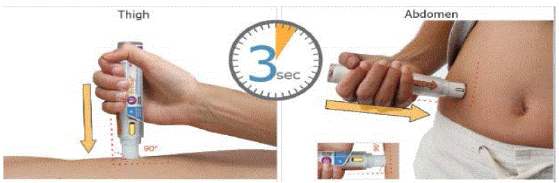 Hold the body of the prefilled syringe in 1 hand between the thumb and index finger. Hold the syringe in your hand like a pencil - Illustration