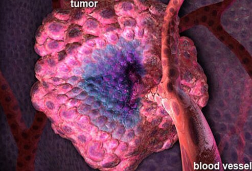 Targeted therapy attacks cancer cells while leaving healthy normal cells alone.
