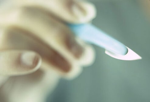 Women at high risk for ovarian cancer can reduce their risk by removing their ovaries.