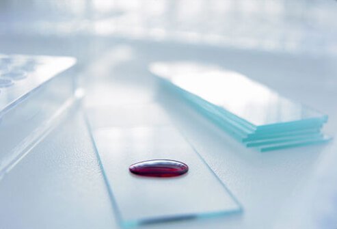 Women at high risk of ovarian cancer may be screened with a blood test measuring CA-125 protein.