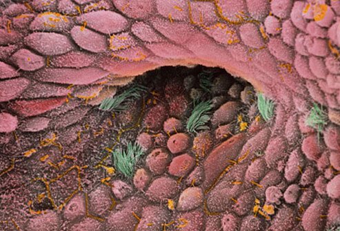 Different cell types within the ovary give rise to different types of ovarian cancer.