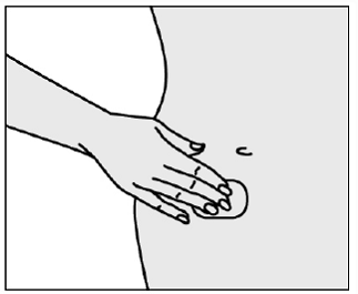 Apply firm pressure over the surface of the patch with your fingers to make sure the patch stays - Illustration