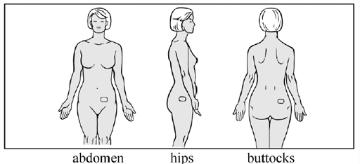 Patch application sites. - Illustration