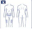 Choose your injection site and wipe the skin with an alcohol swab. Let the injection site dry before you inject your dose - Illustration