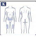 Choose your injection site and wipe the skin with an alcohol swab. Let the injection site dry before you inject your dose - Illustration