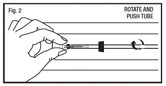 Bending T-Arms of Paragard While in Sterile Packaging - Illustration