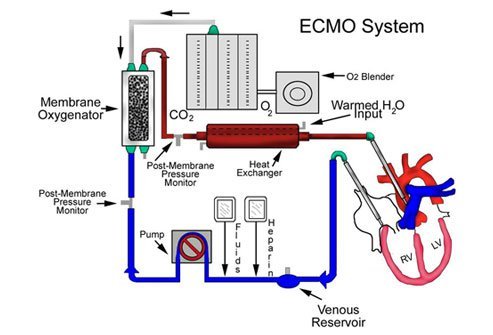 ECMO System Diagram