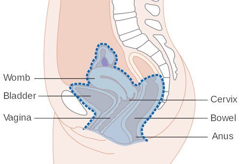 Pelvic exenteration is a long surgery and typically takes 8 hours or longer.