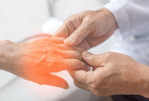 Picture of neuropathy pain in the fingers.
