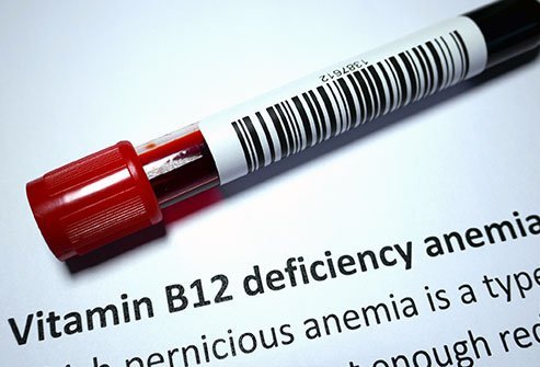 Pernicious anemia is a deficiency in red blood cells caused by lack of vitamin B12 in the blood.
