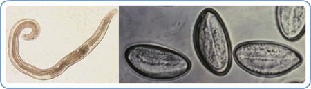 Picture of pinworms
