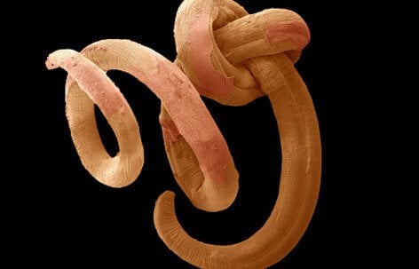 This pinworm image is from a colored scanning electron micrograph (SEM) of the nematode.