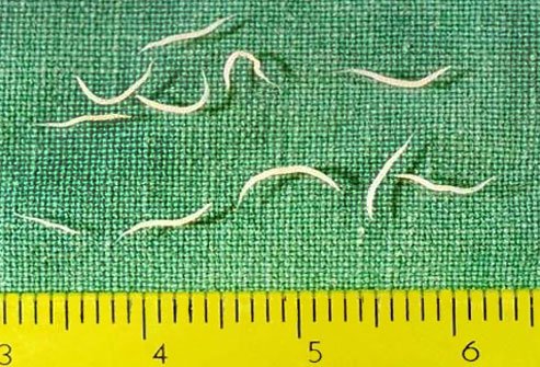 Pinworm infection is common and straightforward.