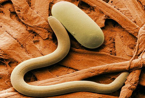 There are several types of worms that can make people sick.