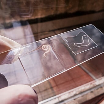 Pinworms are thin white worms that can be seen with the naked eye.