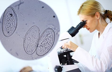 A pinworm tape test may be done to collect and identify pinworm eggs under a microscope.