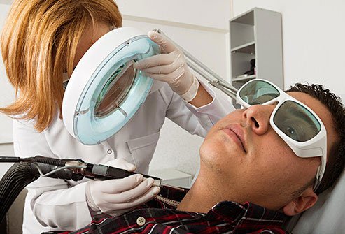 Laser hair removal is a procedure that can permanently remove unwanted hair.