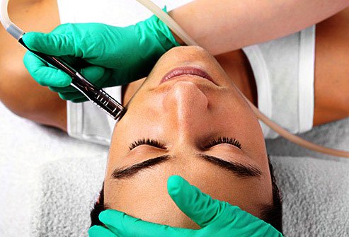 Microdermabrasion reduces the look of age spots, fine lines, and other skin imperfections.